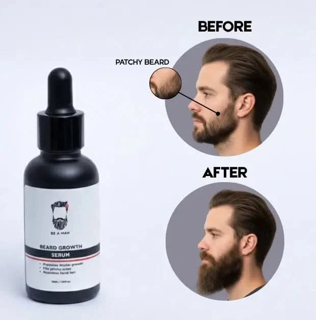 Beard Growth Serum Before and after image