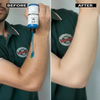 Urea 10% Pre Bath Gel before and after Img 6