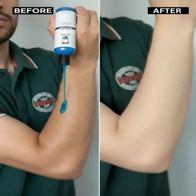 Urea 10% Pre Bath Gel before and after Img 6