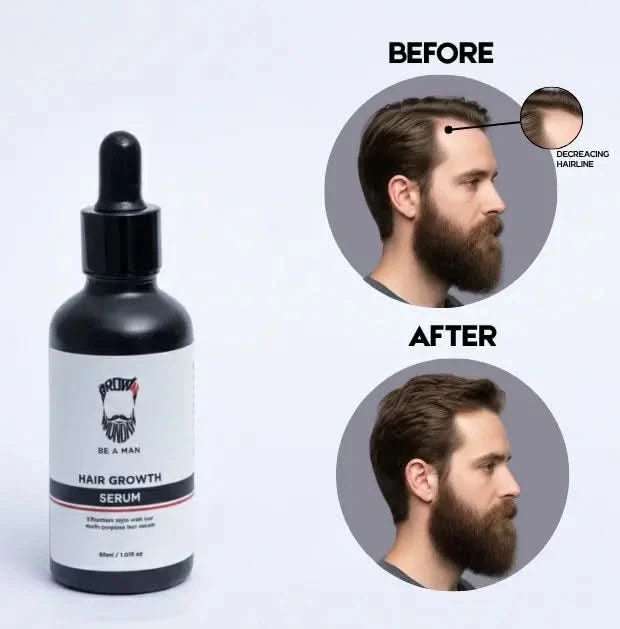 Hair Growth serum Before and after image